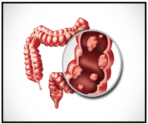 Gastrointestinal (GI) Surgeon in Thane | Dr. Vishwanath Masurkar